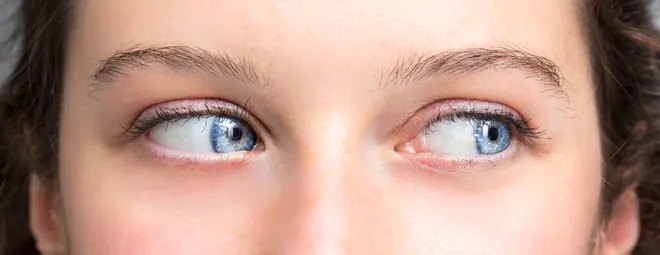 Das Bild zeigt eine Frau, die zur Seite schaut - der typische "side eye"-Blick.